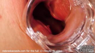 Becky Berry Gyno Exam with Speculum & 6 Gaping Orgasms