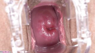 Brunette Slut Masturbates With Speculun Inside